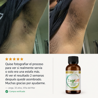 Tag Off — Deja de tapar lo que puedes eliminar
